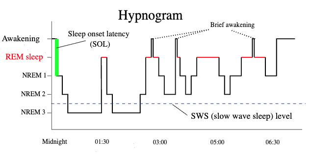 There's Only One Way to Sleep